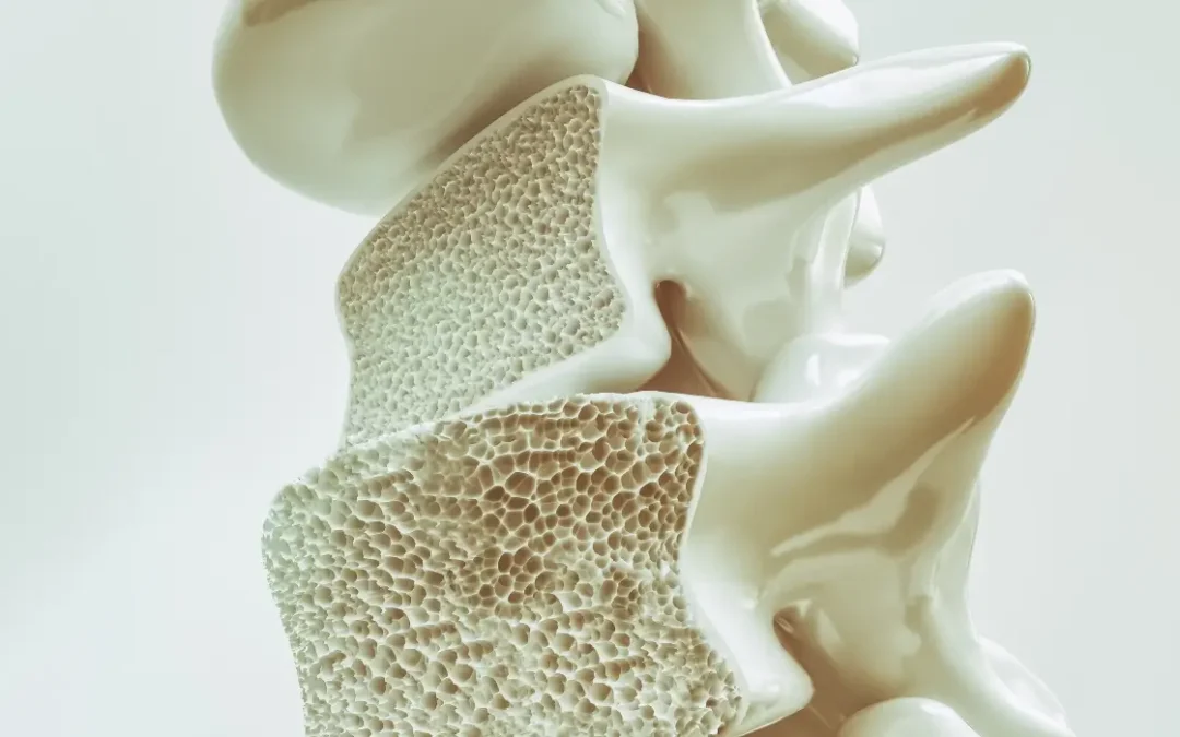 EJERCICIO Y OSTEOPOROSIS: ACTIVA-T