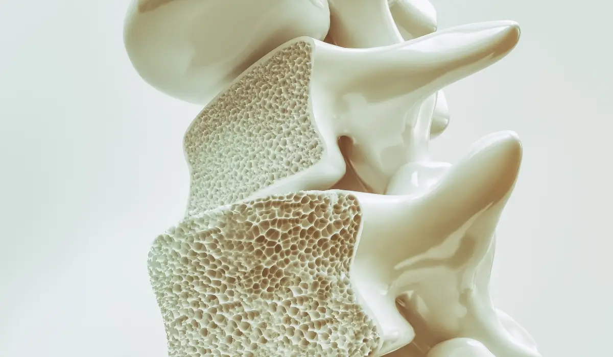 Ejercicios y osteoporosis